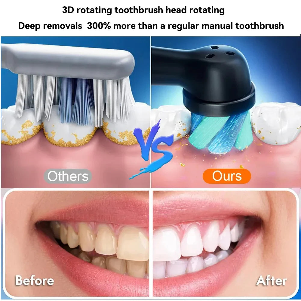 Obrotowa szczoteczka do zębów, czarna/biała, 4 końcówki, ładowana